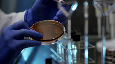 Wissenschaftlerin hält Petrischale mit Bakterienkultur im Labor
