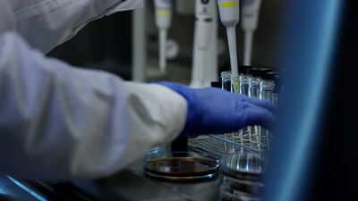 Behandschuhte Hand mit Pipette und Glasröhrchen im Labor, Pipette Labor Nahaufnahme, Glasröhrchen im Ständer und