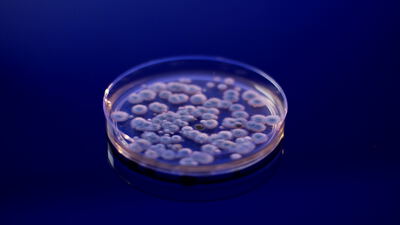 Petrischale mit Kolonien vor einem tiefblauen Hintergrund