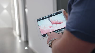 Hand hält ein Tablet mit dentaler Zahnvisualisierung in der Praxis