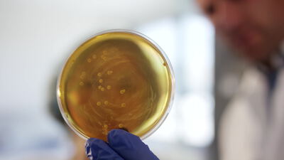 Laborant hält Petrischale mit Bakterienkolonien gegen das Licht Laborant hält Petrischale mit Bakterienkolonien gegen das Licht, Petrischale Nahaufnahme, Labor Nahaufnahme und